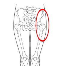 股関節の痛み 足の付け根の痛み 座間市さがみ野の みんなの整骨院